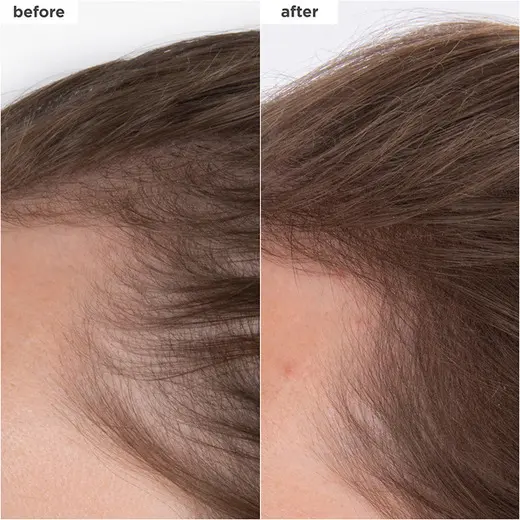 Destined for Density™ MegaStrength Serum ( voor dikker haar) - Afbeelding 2