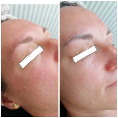 IMG_20220516_211028_050